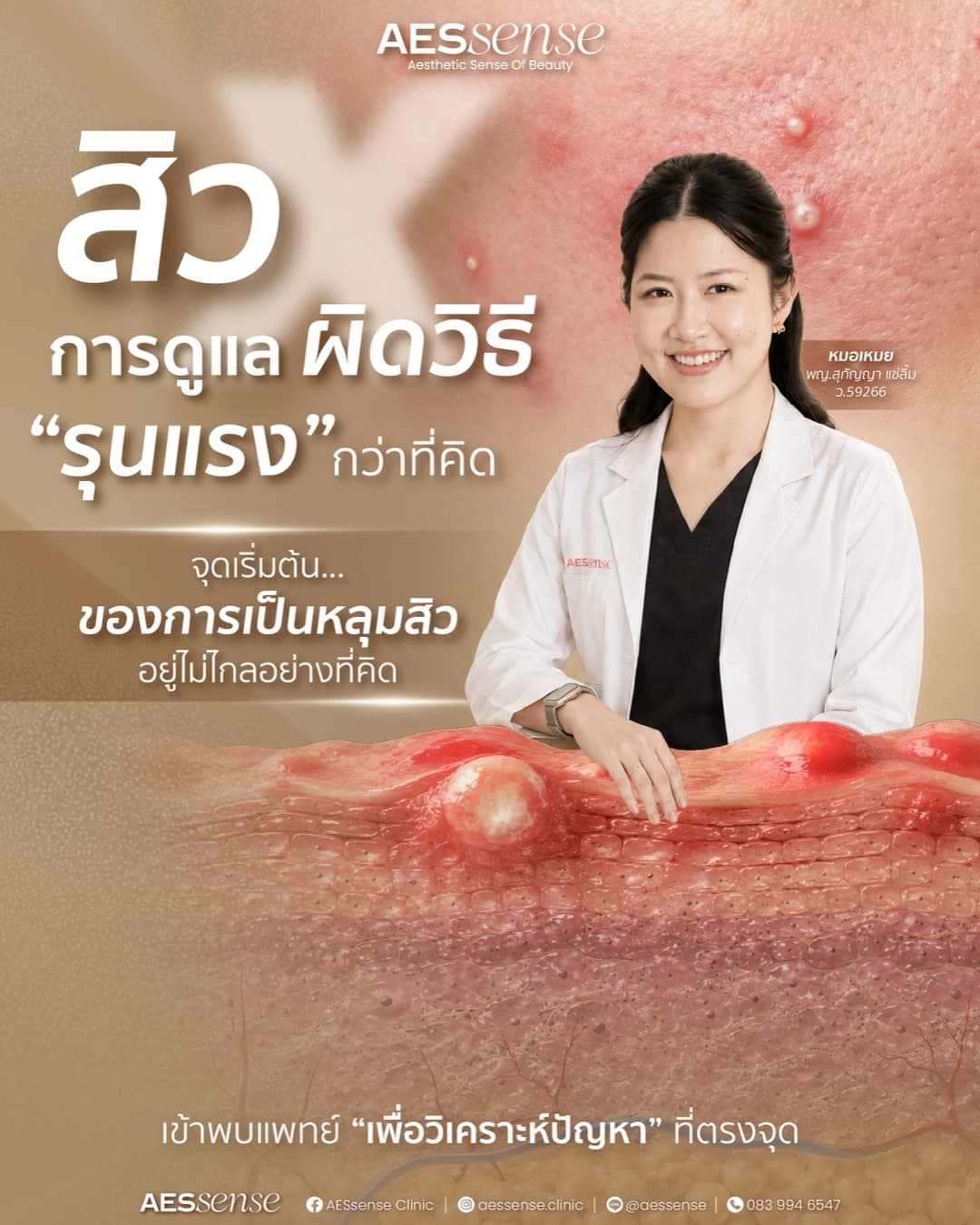 Dr. Mei in a white coat leaning on an illustrated cross section of skin with inflamed acne, with Thai text about acne care