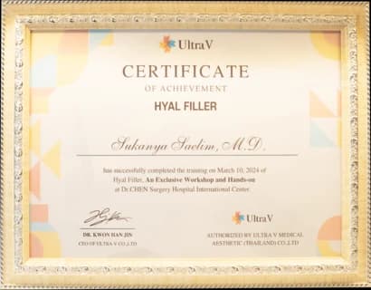 Ultra V Certificate Hyal Filler